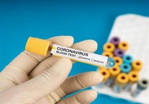 coronavirus کرونا ویروس