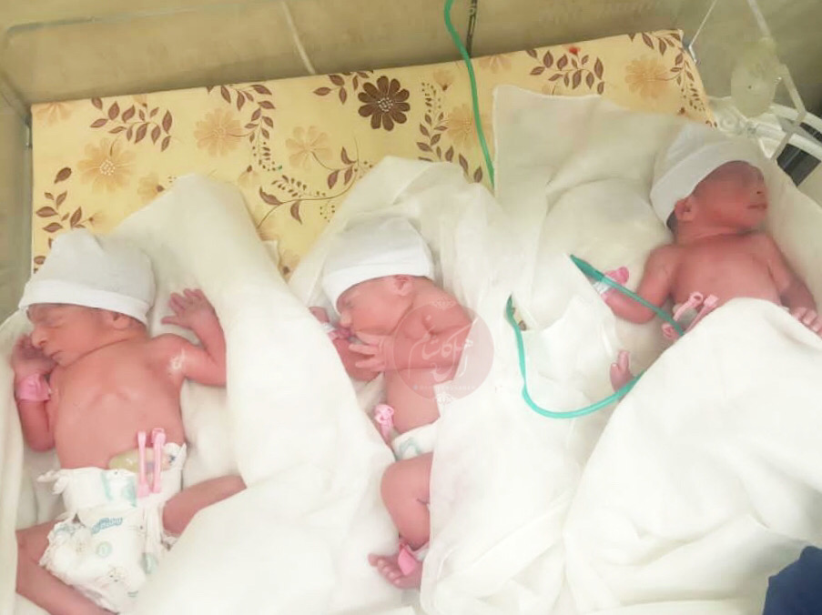 تولد نوزادان سه قلو در کاشان
